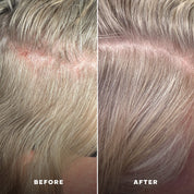 Scalp Wellness Essentials