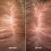 Scalp Wellness Essentials