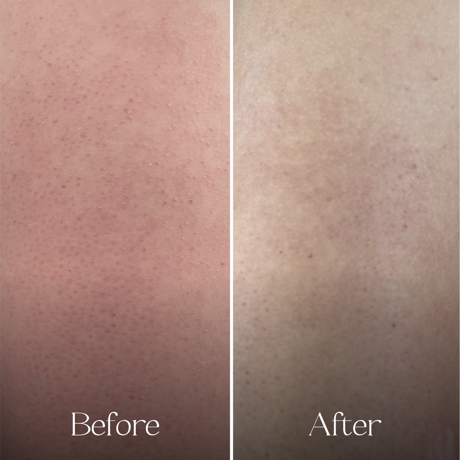 The Skin Smoothing Duo Tin