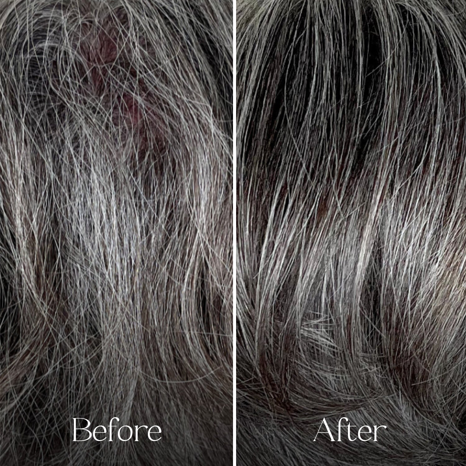 The Haircare Meets Skincare Set Tins