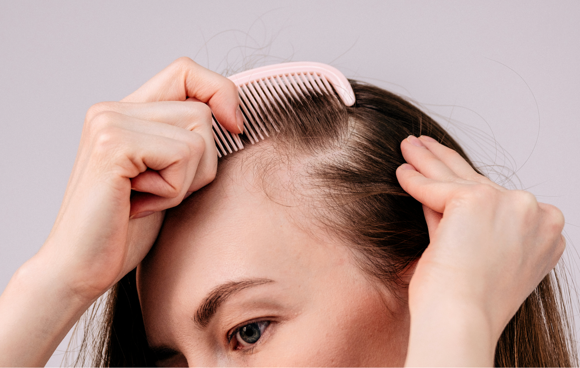 Problem: You Notice Thinning